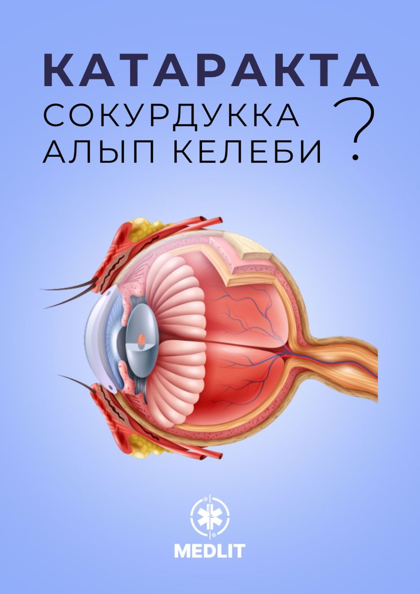 КАТАРАКТА СОКУРДУККА АЛЫП КЕЛЕБИ?