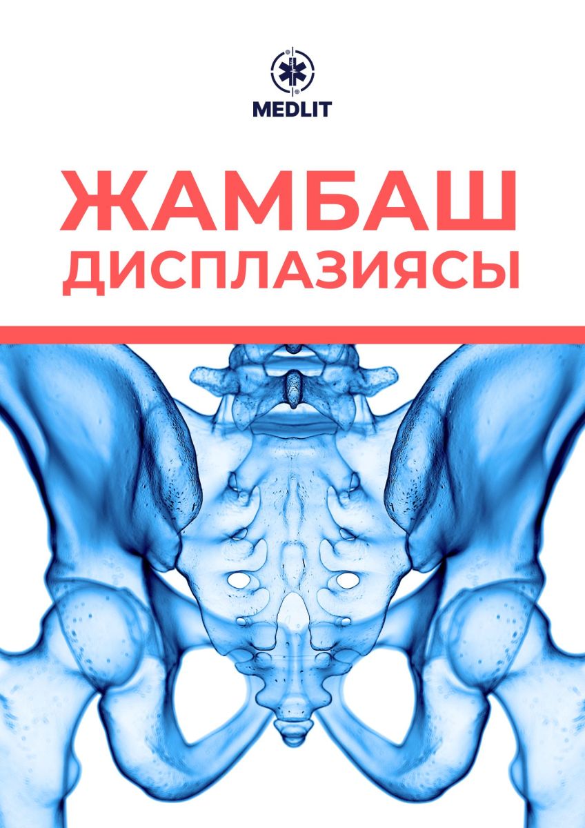 ЖАМБАШ ДИСПЛАЗИЯСЫ